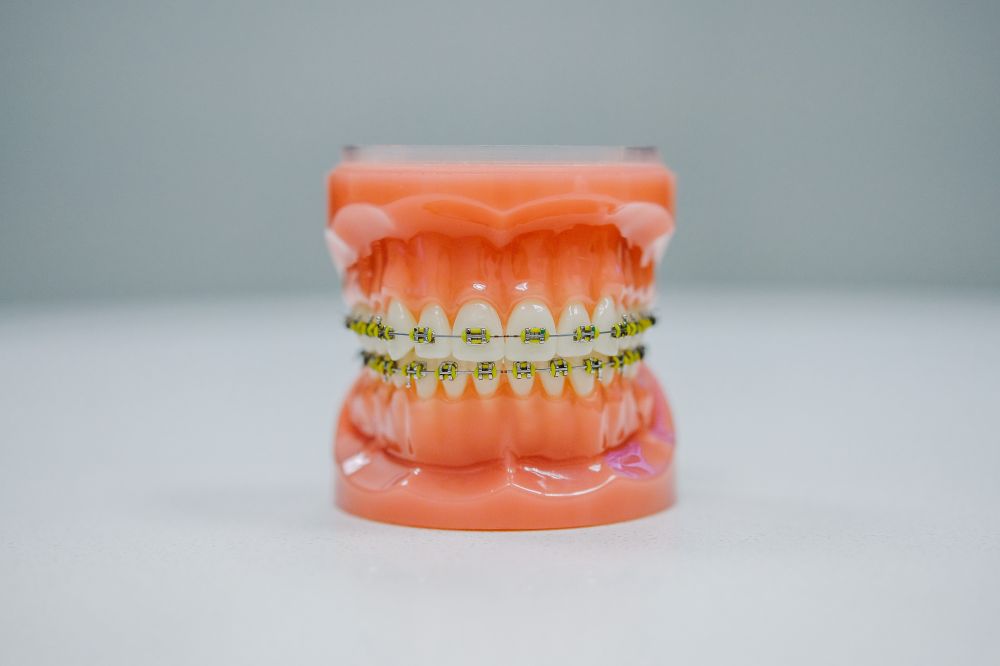 Tannlege i Asker - En guide til å velge riktig tannlege
